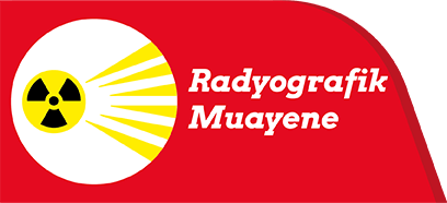 Radyografik Muayene